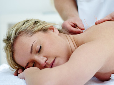 acupunture